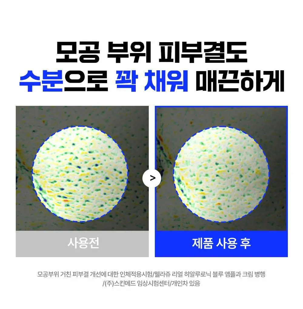 [화잘먹크림] 웰라쥬 리얼 히알루로닉 100 크림 50ml 더블 기획 상세페이지 5